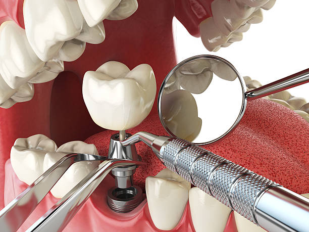 Best Teeth Whitening  in Emah, OK